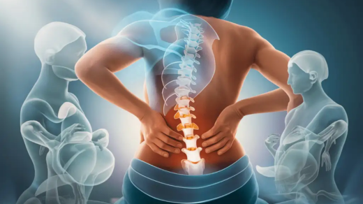 Spondylosis treatment